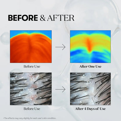 PDRN Scalp Revival Hair Ampoule - detail
