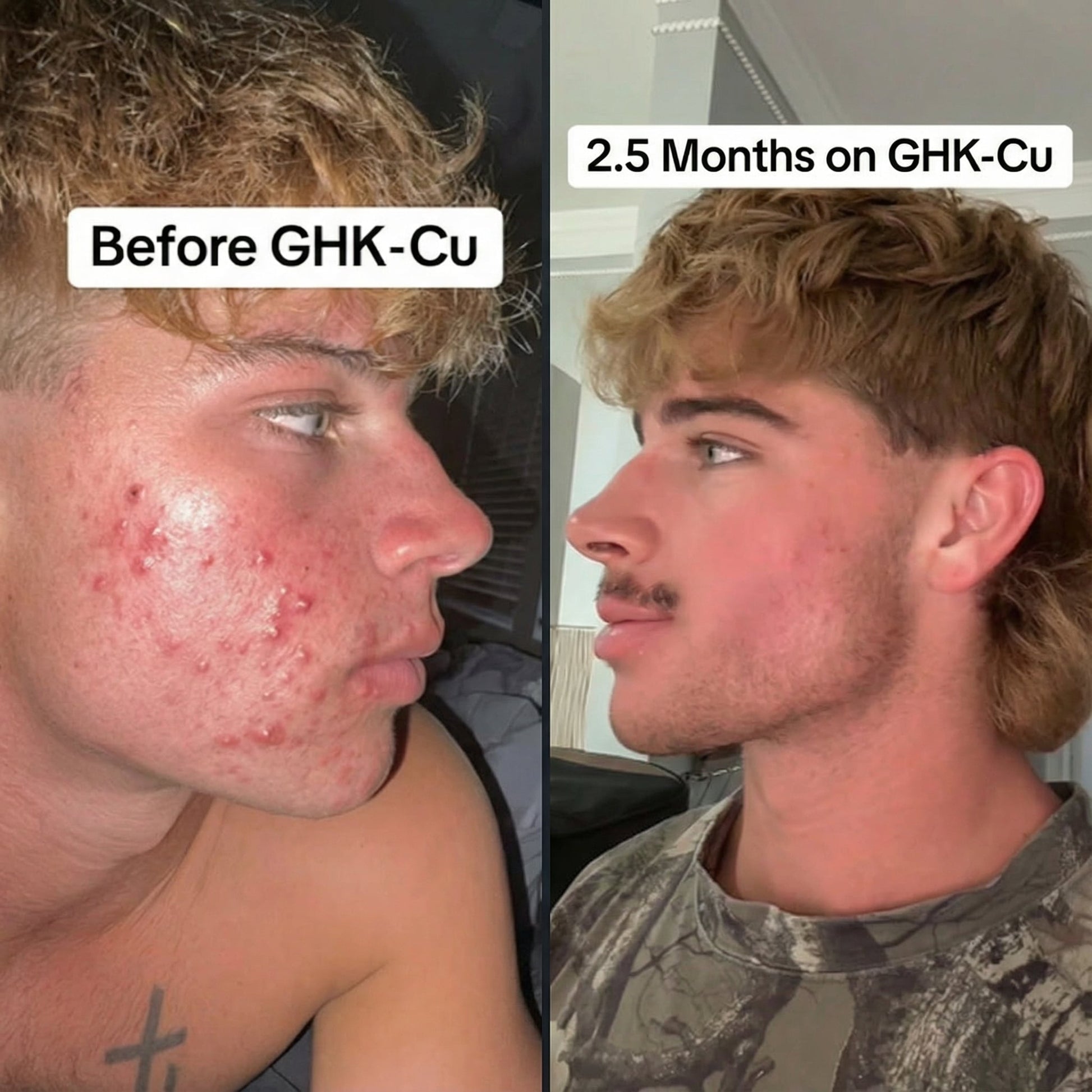 ghk cu peptide looksmaxxing Copper Benefits For Looksmax week 3 of using GHK-Cu